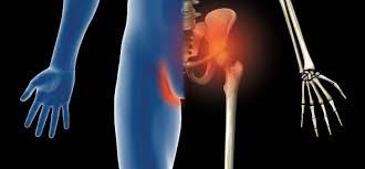 Pinpoint your symptoms and signs with medicinenet's symptom checker. Hip Pain And Groin Strain