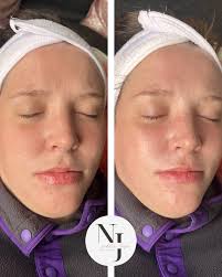 Natalie Jayne Aesthetics (@natalie_jayne_aesthetics) • Instagram photos and  videos