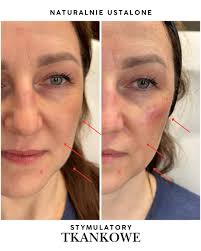 Naturalnie USTAlone Alicja Trela-Twarożek