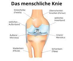 Eine verletzung des inneren meniskus (meniscus medialis) ist dabei signifikant häufiger als die des äußeren meniskus (meniscus lateralis). Knieblockade Meniskusblockade
