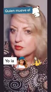 Despues de tres meses del accidente haciendo ejercicios de rehabilitac...