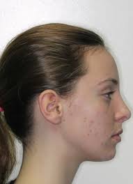 Transform Your Smile with Adult Orthodontic Treatment