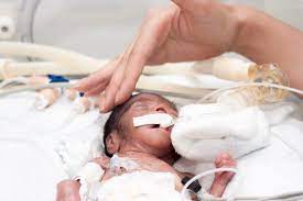 Mereka juga berisiko untuk mengalami komplikasi negatif. Kelahiran Bayi Pramatang June 2021 Kelabmama Malaysia