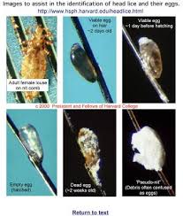 All Stages Of A Louse And Egg Head Louse Lice Life Cycle Lice Removal