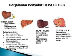 Malaysia, indonesia dan thailand kawasan pertengahan penghidap hepatoma. Apa Perbedaan Antara Hepatitis B Dan Hepatitis C Quora