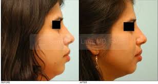 Before & After Photos