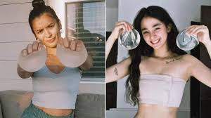 5 Filipino Celebrities Who Regret Getting Breast Implants | Preview.ph