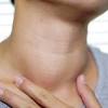 They could be symptoms of lung cancer or head and neck cancer. 1