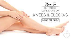 Maybe you would like to learn more about one of these? How To Get Rid Of Dark Knees And Elbows Fast Guide