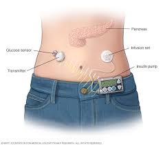 Blood Sugar Testing Why When And How Mayo Clinic