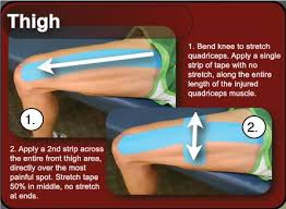 No stretch is applied during application. How To Apply Kinesio Tape Athletic Tape Info Center Part 2