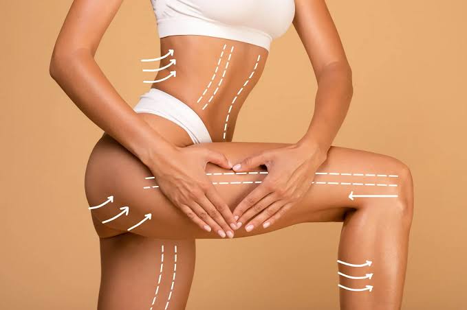 BodyTite Liposuction in Islamabad - ARB Clinic