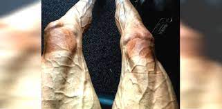 This is what legs look like after 16 stages on the tour de france. Cyclist Posts Photo Of His Veiny Legs After Biking 1 700 Miles Littlethings Com