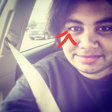 What can help reduce under-eye lines and discoloration?