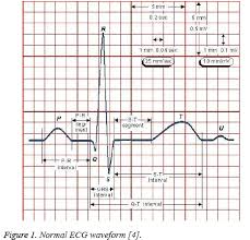 Ecg Signal Classification And Parameter Biomedical Research