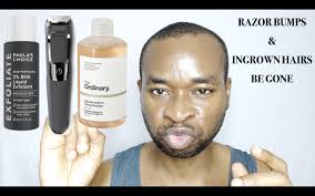 Everyone gets ingrown hairs on the face & neck from time to time. How I Prevent And Get Rid Of Razor Bumps Ingrown Hairs Skin Care
