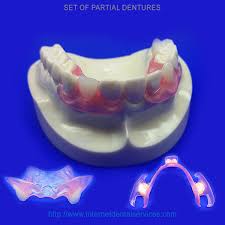 partial denture from home dental kit