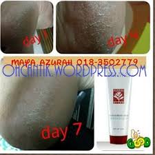 Kasut yang sesuai memainkan peranan yang penting dalam keselesaan tapak kaki. Cara Hilangkan Tumit Pecah Paling Mudah Berkesan Ohcantik Com