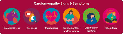 Image result for Cardiomyopathy