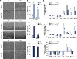 Tweety wysyłane przez tego użytkownika będą widoczne tutaj. Supplemental Materials For Tgfb Overrides Hnf4a Tumor Suppressing Activity Through Gsk3b Inactivation Implication For Hepatocellular Carcinoma Gene Therapy Journal Of Hepatology
