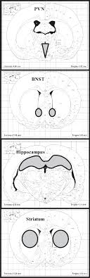 Cele mai bune proteine de origine vegetală includ. Dissection Guide For Sites Of Interest Based On The Rat Brain Atlas Download Scientific Diagram