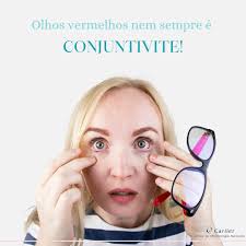 Nem sempre o “olho vermelho” significa que você está com conjuntivite! A  uveíte é uma afecção ocular que também deixa os olhos vermelhos. Ela poderá  causar embaçamento visual, dor e sensibilidade. Outras