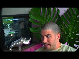 Nickmercs Panics On Livestream After Noticing A Dent On His Head