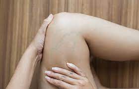 Thrombose Symptome Anzeichen Behandlung Was Tun Minimed At