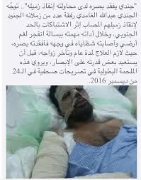 بعض الصور من بطولات جنود الجيش السعودي بالحد الجنوبي بالجنوب Event