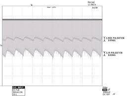 Pulse oximetry is universally used for monitoring patients in the critical care setting. Measuring Heart Rate And Blood Oxygen Levels For Portable Medical And Wearable Devices Embedded Computing Design