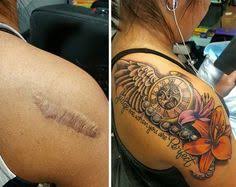 They can form after any skin trauma, but do tattoos increase the chances? Emblematic Keloid Scar Tattoo Cover Tattoo Around Keloid Scar In 2020