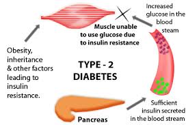 Diabetes adalah penyakit kronik yang akan kekal seumur hidup. Diabetes Diabetes Tahap 2