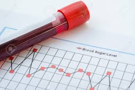 Sample Blood For Screening Diabetic Test In Blood Tube On Blood