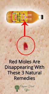 Red Moles Are Disappearing With These 3 Natural Remedies Organic Food Office Red Moles Organic Recipes Mole