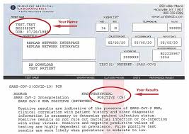 Alternatively you may contact your desired location and email your information prior to your visit. Understanding Your Pcr Nasal Swab Test Results Citymd
