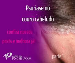 Psoríase causa queda de cabelo? Psoriase No Couro Cabeludo Amigos Com Psoriase Facebook
