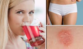 First clean your affected skin and dry it. Thrush Or Ringworm Rid Yourself Of Fungal And Yeast Infections With This Diet Express Co Uk