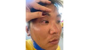 Pengusaha Perikanan Dianiaya Oknum TNI AL, Mau Visum Ditolak RSU FL Tobing,  Begini Kata Danlanal Sibolga