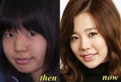 When i started getting more seriously into kpop they were already on top with gee, oh this topic is now archived and is closed to further replies. Sunny Snsd Plastic Surgery Before And After Plastic Surgery Hits