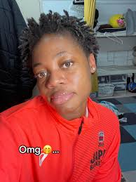 Medicube Pads Before and After Hyperpigmentation