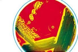 Check spelling or type a new query. Clostridium Perfringens