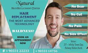 Best Non Surgical Hair Replacement Systems Hair Replacement Systems Hair Loss Solutions Natural Hair Styles