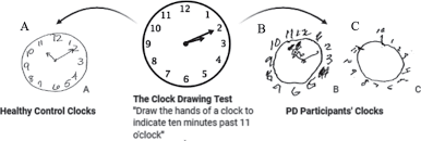 Image result for Clock Drawing Test