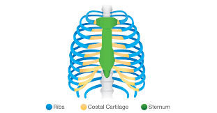 What Is Costochondritis Costochondritis Com