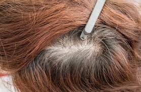 كيفية علاج تقصف الشعر من الامام وتطويل الشعر بدون قص Hairstyles For Thin Hair Increase Hair Growth Hair Extension Salon
