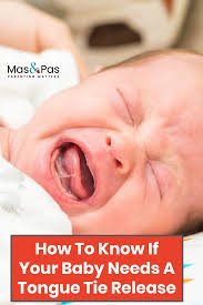 How To Know If Your Baby Needs A Tongue Tie Release Baby Tongue Tongue Tie Tounge Tied Baby