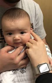 Loaner hearing aid program help brothers Connor and Roman prepare for  cochlear implants