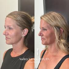 STL hasn't seen anything like it! RA Kirkwood grand opening ✨🖤