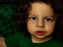 Recognizing A Broken Nose Self Care Treatment And Recovery