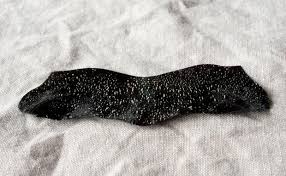 Schwarze Punkte Auf Der Nase Nicht Immer Mitesser Woman At